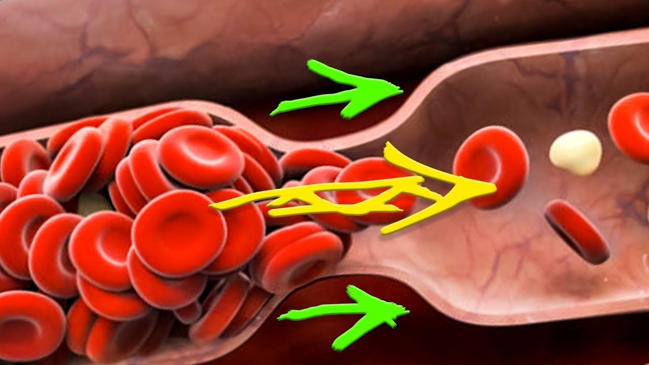 Кардиолог перечислил симптомы густой крови – Москва 24, 